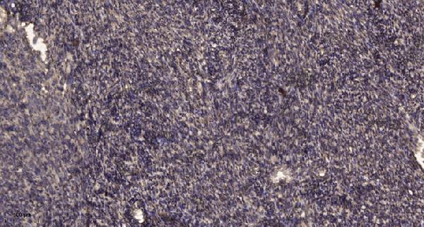 a04164 1 tmprss3 primary antibodies ihc testing 5