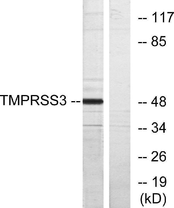 a04164 1 tmprss3 primary antibodies wb testing 3