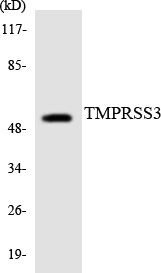 a04164 1 tmprss3 primary antibodies wb testing 4