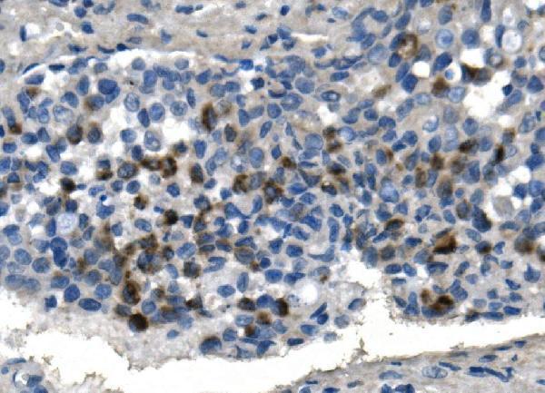 a04164 2 tmprss3 primary antibodies ihc testing 2