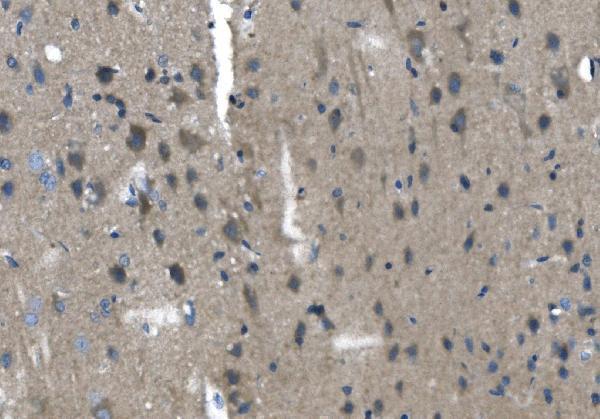 a04164 2 tmprss3 primary antibodies ihc testing 3
