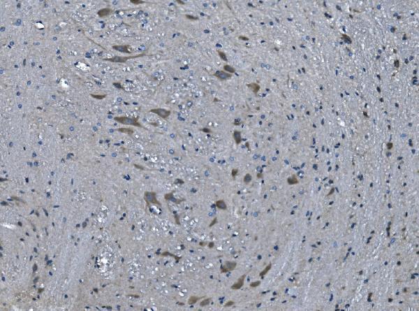 a04164 2 tmprss3 primary antibodies ihc testing 4