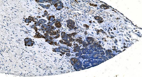 a04164 2 tmprss3 primary antibodies ihc testing 5