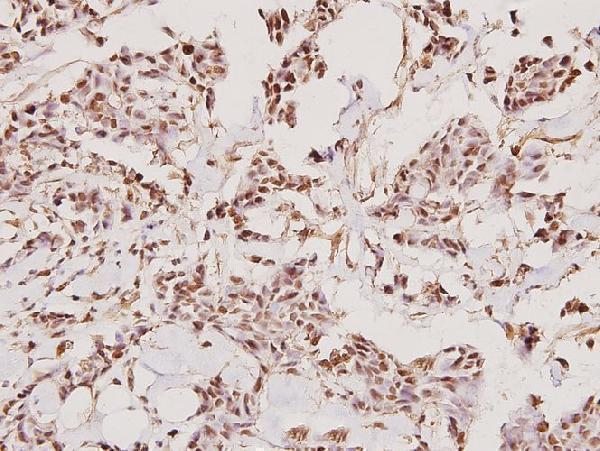 a04164 tmprss3 primary antiboties ihc testing 2