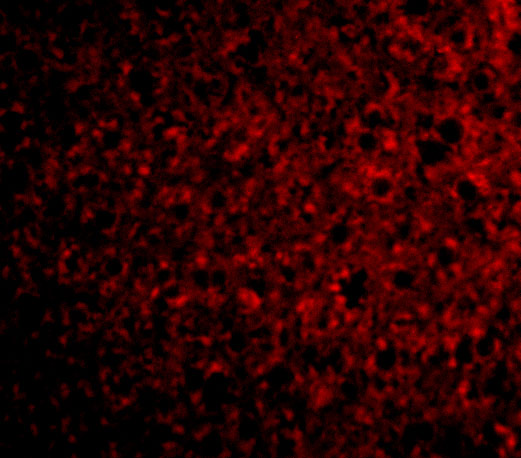 Immunofluorescence of TSLP Receptor in Mouse Liver cells with TSLP Receptor antibody at 20 μg/mL