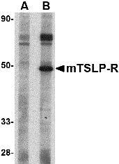 Western blot analysis of TSLP Receptor in mouse heart tissue lysate with TSLP Receptor antibody at 1 μg/mL in (A) the presence and (B) the absence of blocking peptide