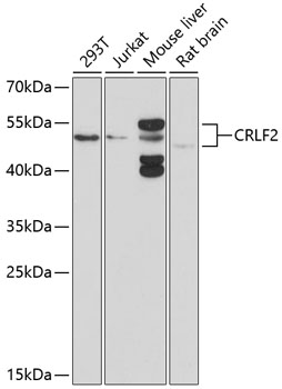 Western blot analysis of extracts of various cell lines, using CRLF2 antibody  at 1:1000 dilution
