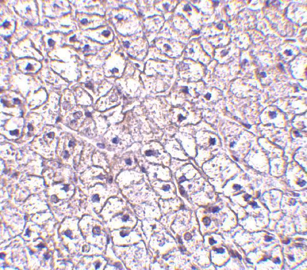 Immunohistochemistry of TSLP-R in human liver tissue with TSLP-R antibody at 5 μg/mL