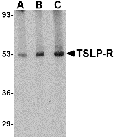 Western blot analysis of TSLP Receptor in human liver tissue lysate with TSLP Receptor antibody at (A) 0
