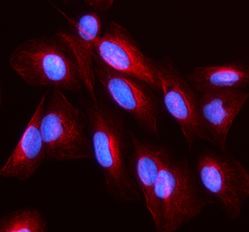 a04168 hsp105 primary antibodies if testing 1