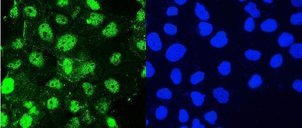 a04168 hsp105 primary antibodies if testing 6