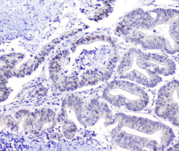 a04168 hsp105 primary antibodies ihc testing 4