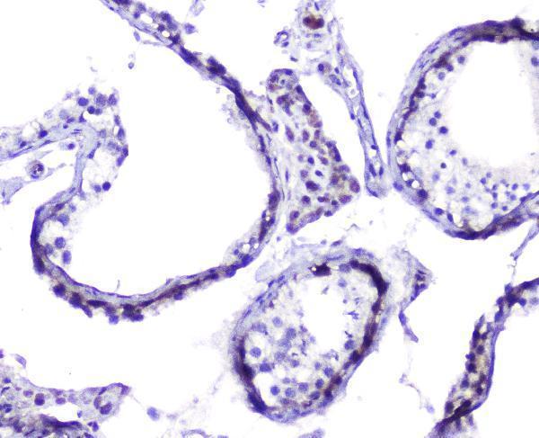 a04168 hsp105 primary antibodies ihc testing 5