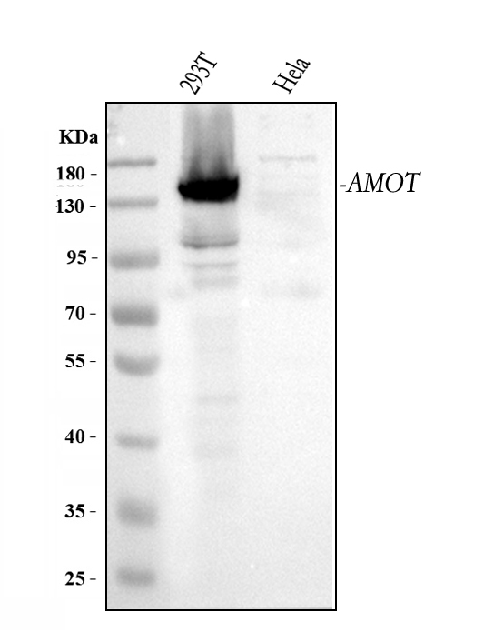  Western blot analysis of Angiomotin/AMOT using anti-Angiomotin/AMOT antibody (A04170-1)