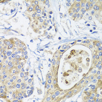 a04171 gsta2 primary antiboties ihc testing 2