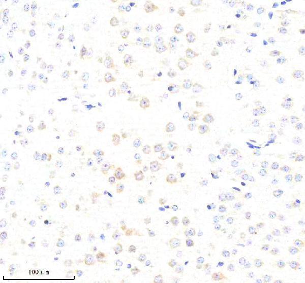  IHC analysis of ABCE1 using anti-ABCE1 antibody (A04173)