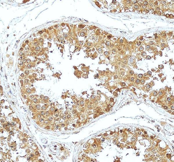 IHC analysis of ABCE1 using anti-ABCE1 antibody (A04173)