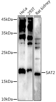 a04174 sat2 primary antiboties wb testing 1