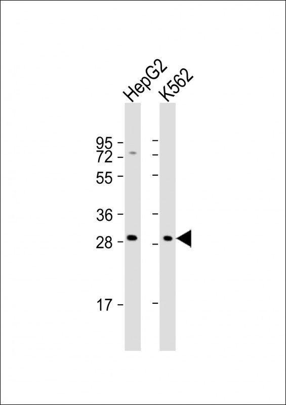 All lanes : Anti-KLRC1 Antibody (C-term) at 1:2000 dilution Lane 1: HepG2 whole cell lysates Lane 2: K562 whole cell lysates Lysates/proteins at 20 microg per lane. Secondary Goat Anti-Rabbit IgG, (H+L), Peroxidase conjugated at 1/10000 dilution Predicted band size : 26 kDa Blocking/Dilution buffer: 5% NFDM/TBST.
