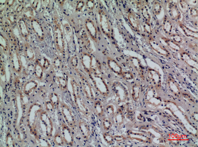 Immunohistochemical analysis of paraffin-embedded human-kidney, antibody was diluted at 1:100