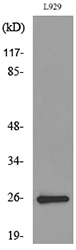 Western blot analysis of lysate from L929 cells, using KLRC1/2/3 Antibody