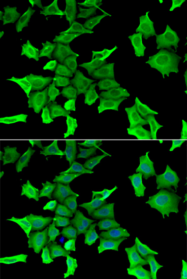 Immunofluorescence analysis of HeLa cells using SPINT2 antibody 