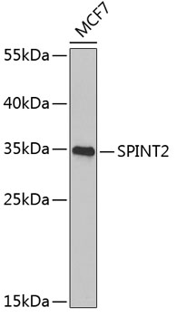Western blot analysis of extracts of MCF-7 cells, using SPINT2 Antibody  at 1:1000 dilution