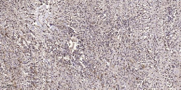 a04177 1 grb14 primary antibodies ihc testing 1