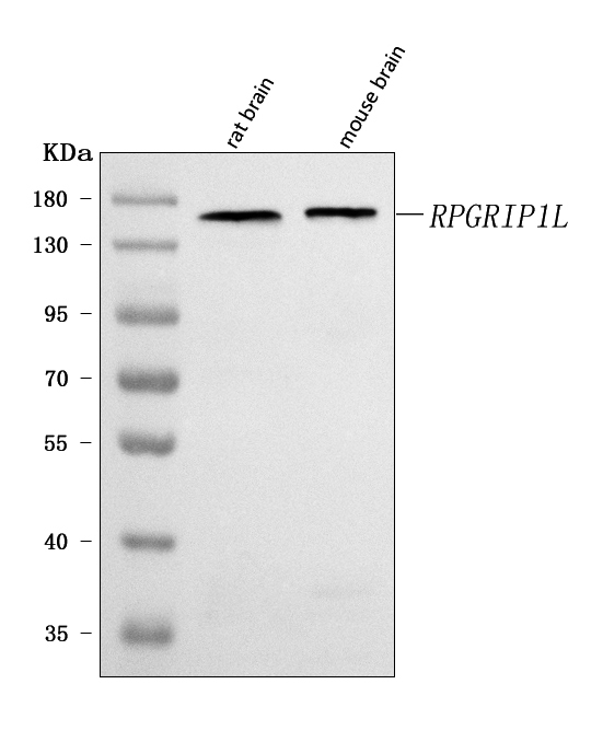  Western blot analysis of RPGRIP1L using anti-RPGRIP1L antibody (A04178-2)