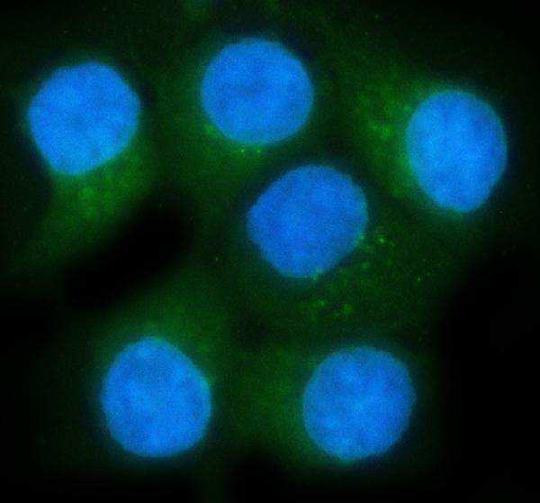 a04179 2 gdi1 primary antibodies if testing 1