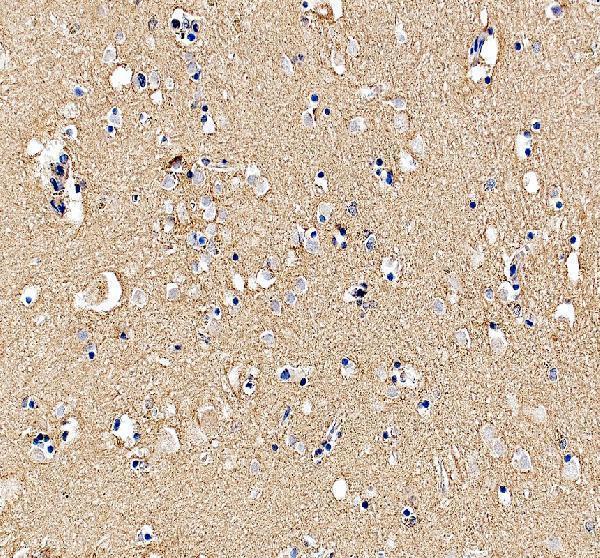 IHC analysis of GDI1 using anti-GDI1 antibody (A04179-2)