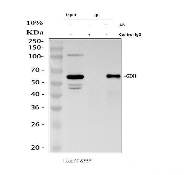 Immunoprecipitating GDI1 in SH-SY5Y whole cell lysate