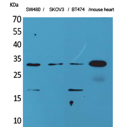 Western Blot analysis of SW480, SKOV3, BT474, mouse heart cells using FGF-18 Polyclonal Antibody