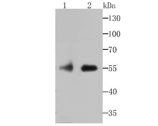 Western blot analysis of FKBP51 on rat kidney tissue and Daudi cell lysate using anti-FKBP51 antibody at 1/500 dilution