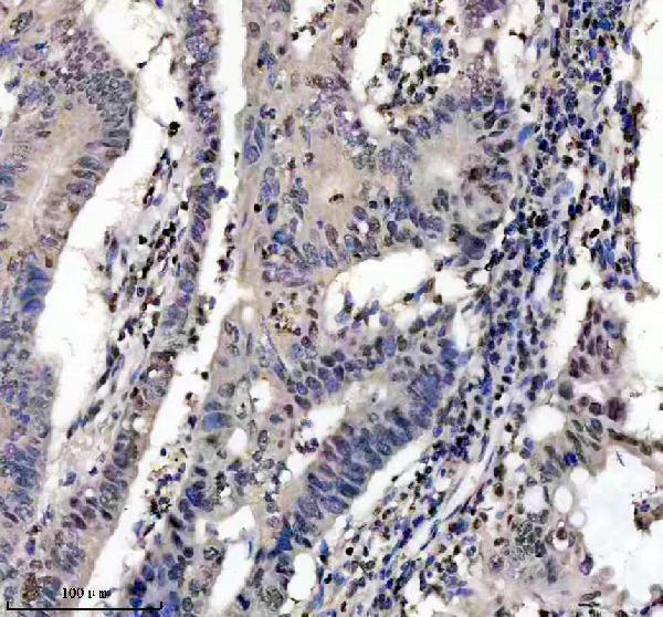 IHC analysis of FKBP5 using anti-FKBP5 antibody (A04182-2)