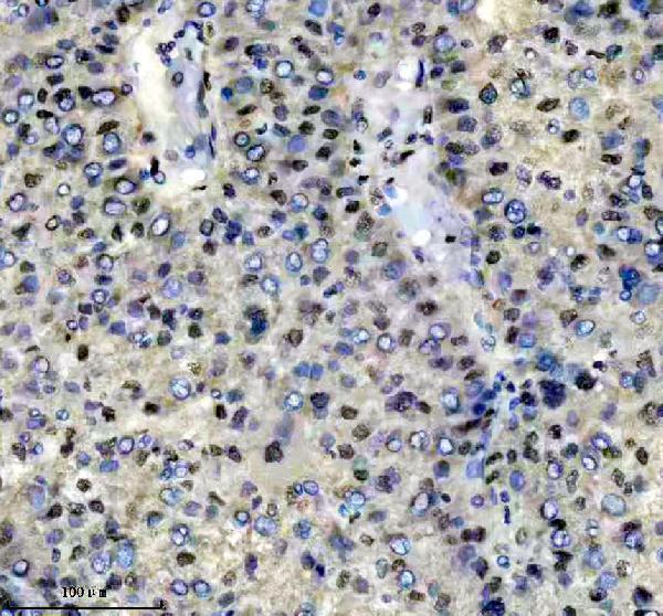 IHC analysis of FKBP5 using anti-FKBP5 antibody (A04182-2)