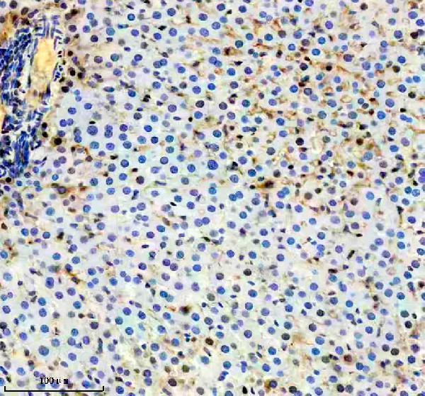 a04182 2 fkbp5 primary antibodies ihc testing 4