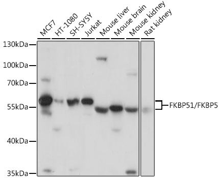 Western blot analysis of extracts of various cell lines, using FKBP51/FKBP51/FKBP51/FKBP5 antibody  at 1:3000 dilution