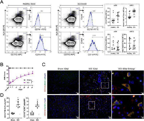 cDC1s in SCI patients and mouse model of SCI