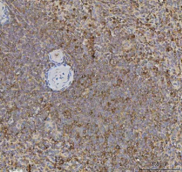 a04185 1 xcr1 primary antibodies ihc testing 2