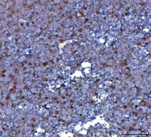 a04185 1 xcr1 primary antibodies ihc testing 3