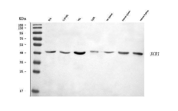  Western blot analysis of CCXCR1/XCR1 using anti-CCXCR1/XCR1 antibody (A04185-1)