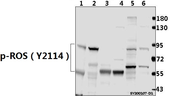 Western blot (WB) analysis of p-ROS（Y2114) pAb at 1:500 dilution
Lane1:C6 whole cell lysate(40ug)
Lane2:Hela whole cell lysate(40ug)
Lane3:The Brain tissue lysate of Mouse(40ug)
Lane4:The Brain tissue lysate of Rat(40ug)  
Lane5:HEK293T whole cell lysate(40ug)
Lane6:A549 whole cell lysate(40ug)