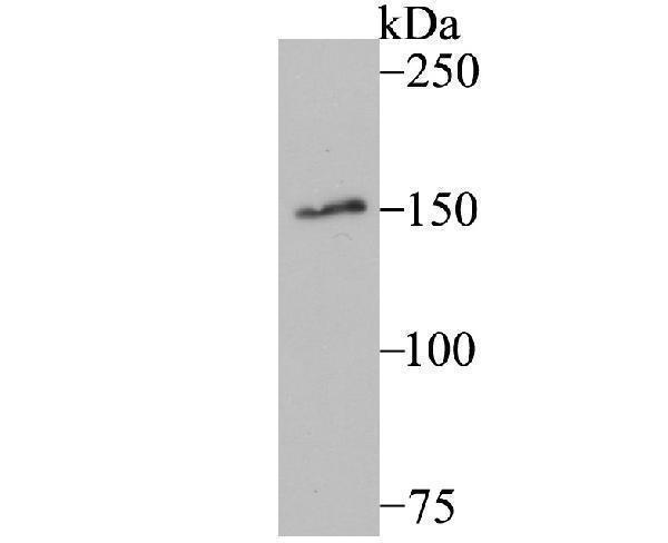 Western blot analysis of MYBBP1A on A549 cell using anti-MYBBP1A antibody at 1/500 dilution