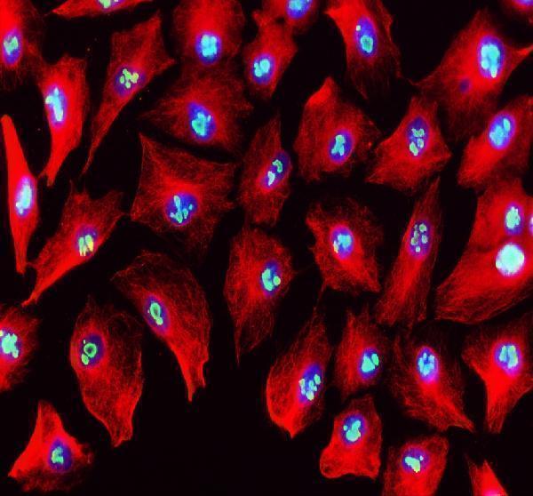 IF analysis of MYBBP1A using anti-MYBBP1A antibody (A04187-3) and anti-Beta Tubulin antibody (M01857-3)