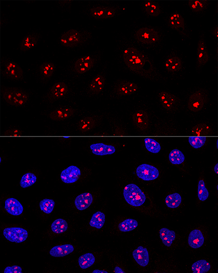 Confocal immunofluorescence analysis of U2OS cells using MYBBP1A Polyclonal Antibody  at dilution of 1:200