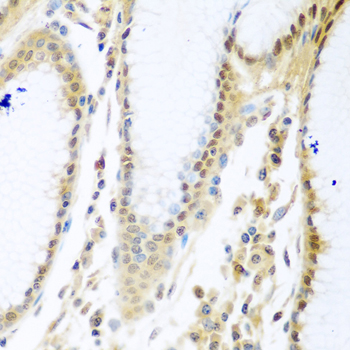 Immunohistochemistry of paraffin-embedded rat lung using MYBBP1A Rabbit pAb  at dilution of 1:100 