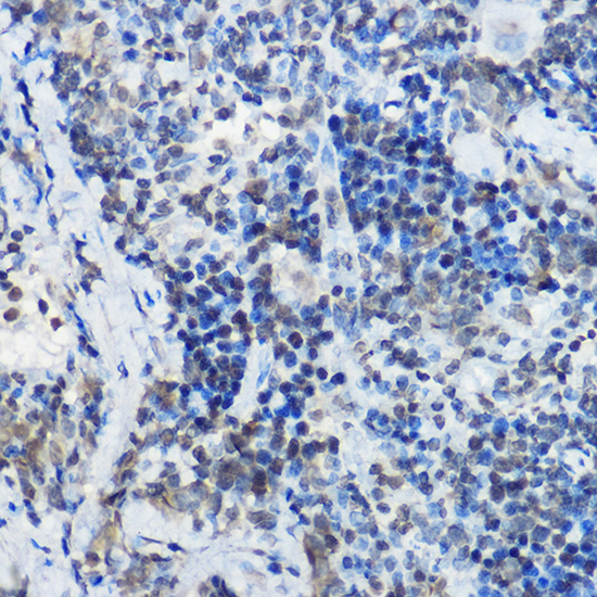 a04187 mybbp1a primary antiboties ihc testing 3