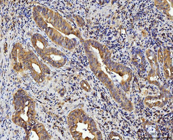 a04190 3 rpl10 primary antibodies ihc testing 2_1