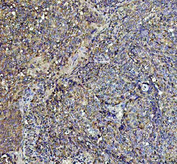 a04191 1 ago3 primary antibodies ihc testing 2_1